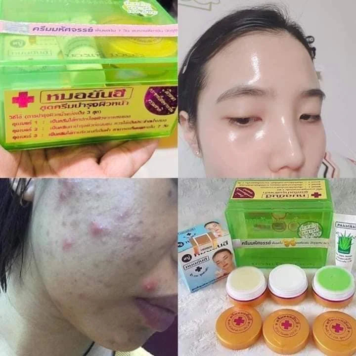 Dr Yanhee Anti Pimple & Severe Acne Treatment Facial Set (GREEN SET)