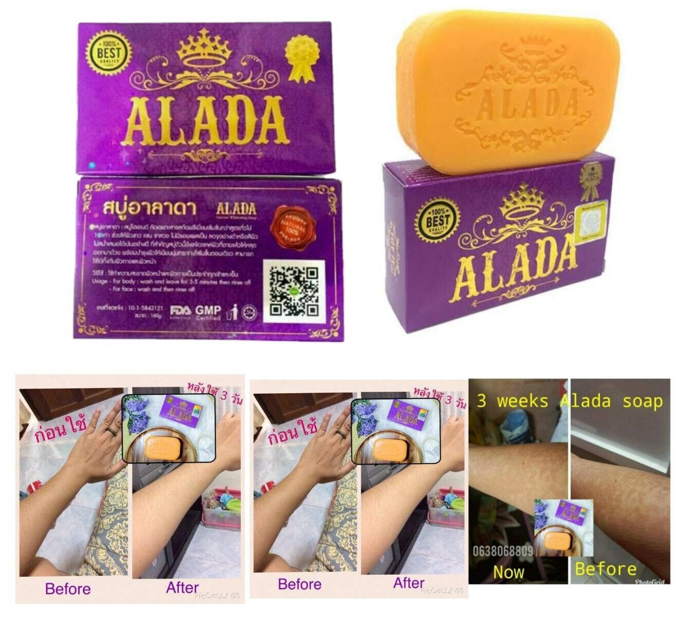 ALADA Instant Whitening Soap Reduce Dark Melasma Anti Spots Acne Original 160 g